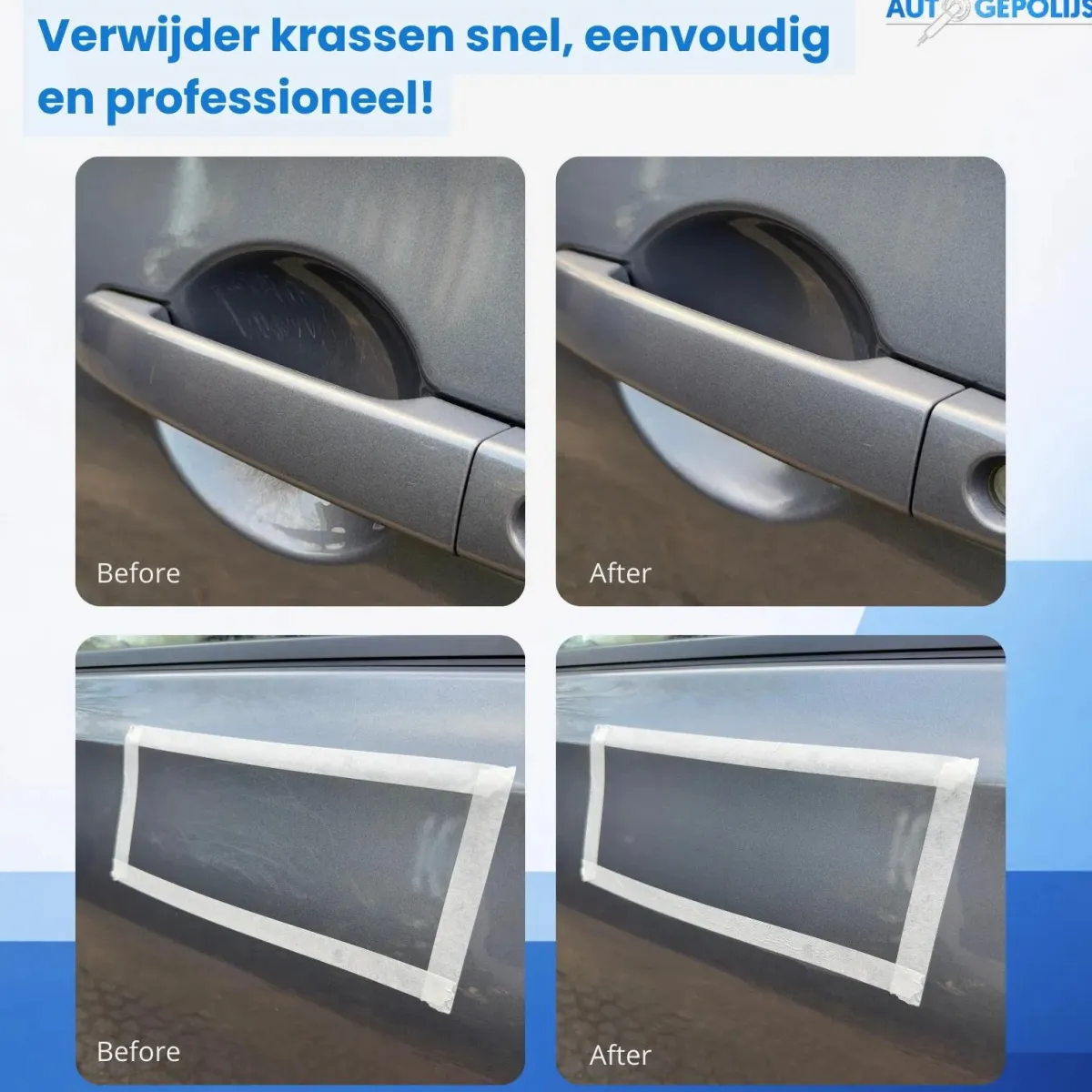 New Krasverwijderaar Pro Set - Polijstset - 10 Delig Auto Polijsten